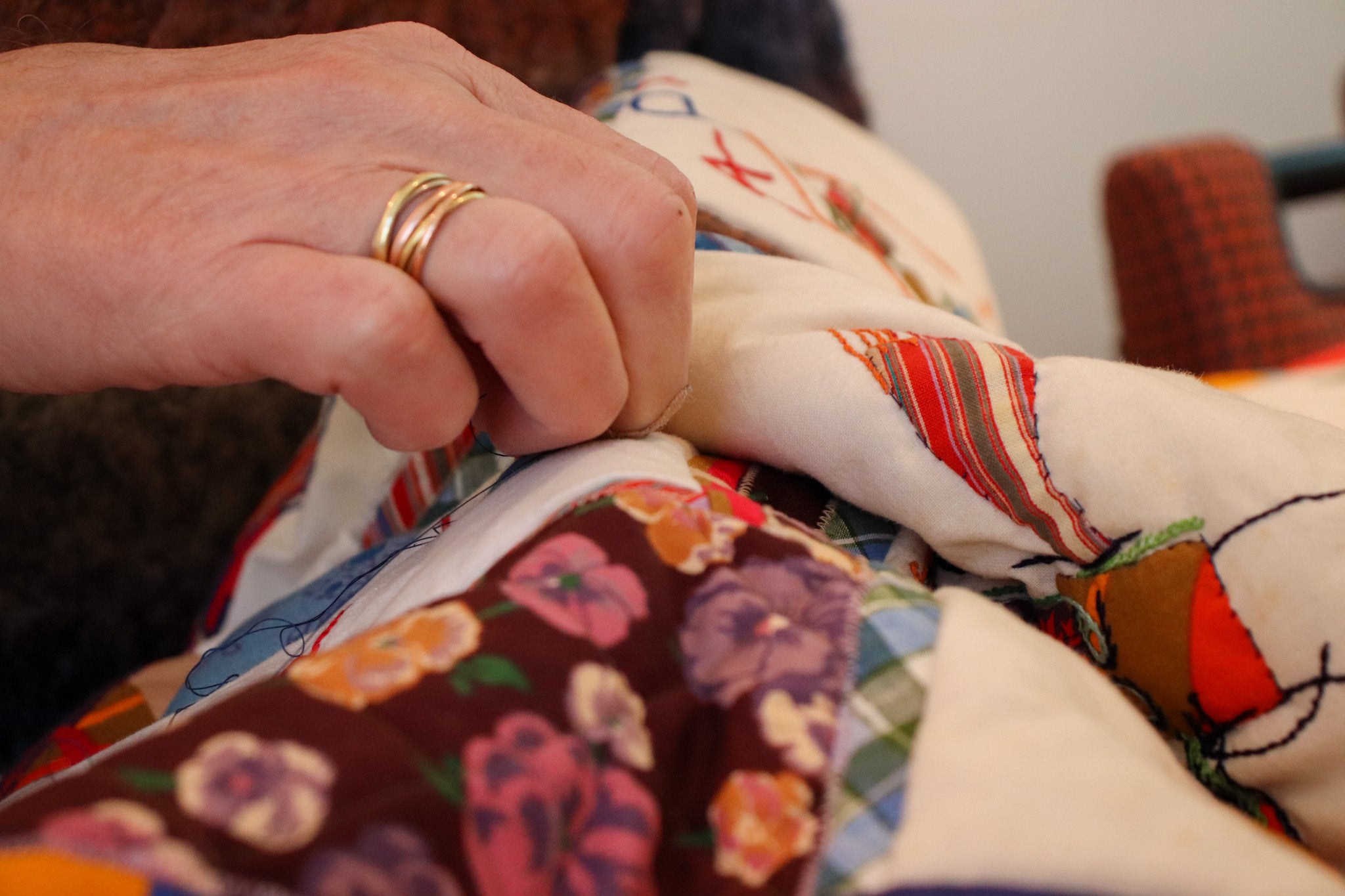 Lewis's story - Stitching can transform lives